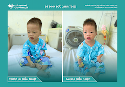 TIN VUI TỪ BÉ ĐỨC ĐẠI – CA MỔ TIM SỐ 565