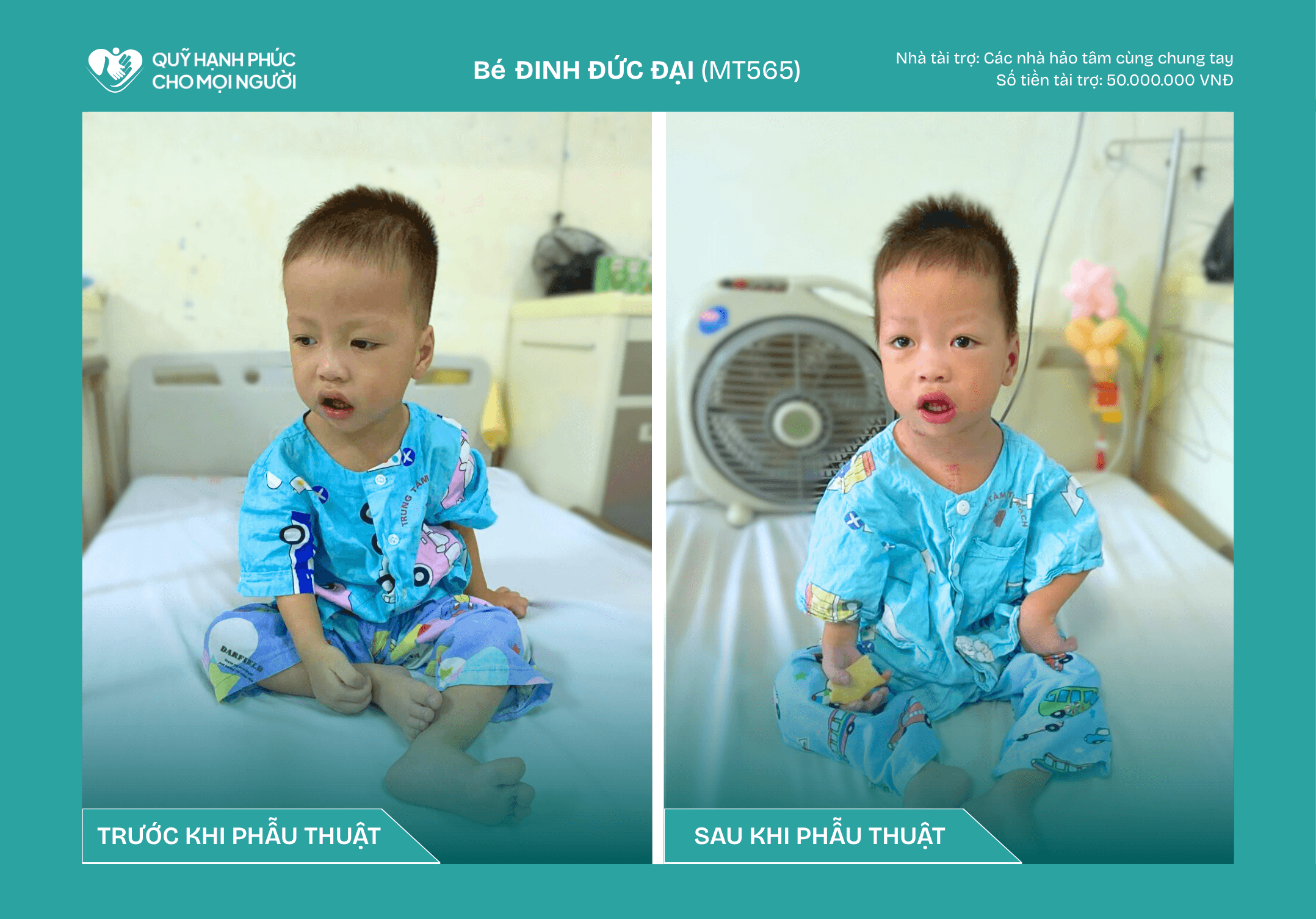 TIN VUI TỪ BÉ ĐỨC ĐẠI – CA MỔ TIM SỐ 565