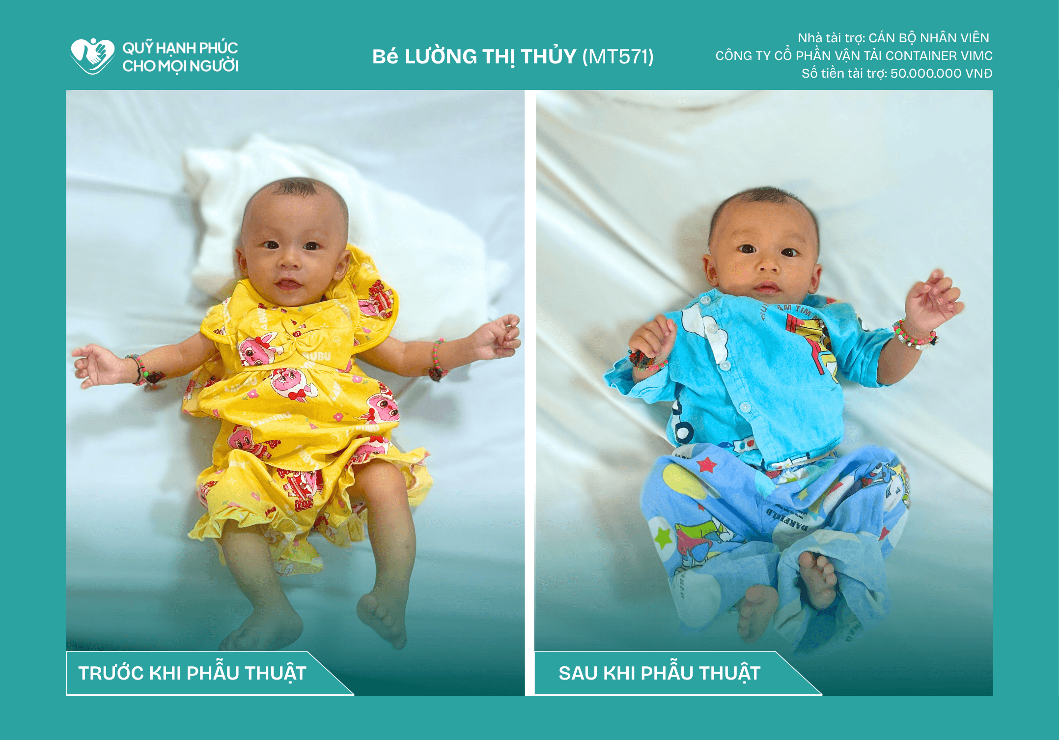 Một Trái ❤️ Nhỏ Được Hồi Sinh - Bé Lường Thị Thủy Đã Xuất Viện!