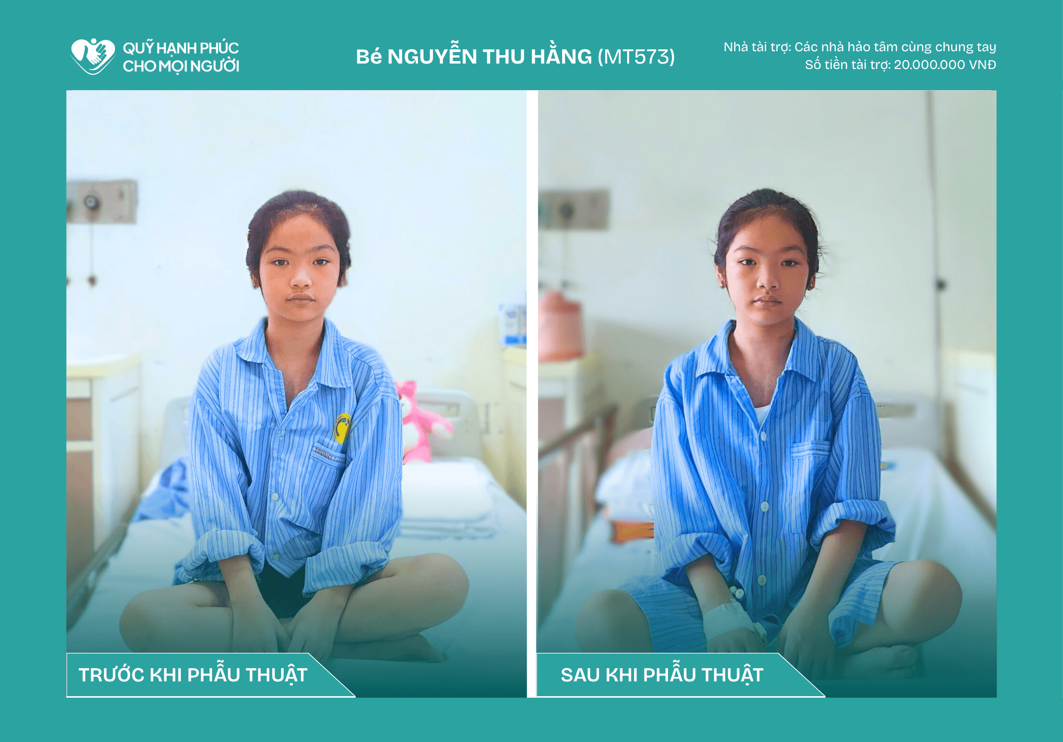 TIN VUI: BÉ NGUYỄN THU HẰNG (CA SỐ 573) ĐÃ ĐƯỢC XUẤT VIỆN!