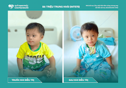 TIN VUI: BÉ TRIỆU TRUNG KHẢI (CA SỐ 575) ĐÃ ĐƯỢC XUẤT VIỆN!