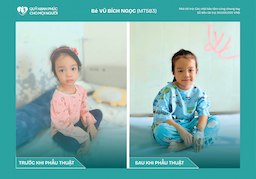 BÉ VŨ BÍCH NGỌC - MỘT TRÁI TIM NHỎ KHỎE MẠNH NHỜ TẤM LÒNG NHÂN ÁI