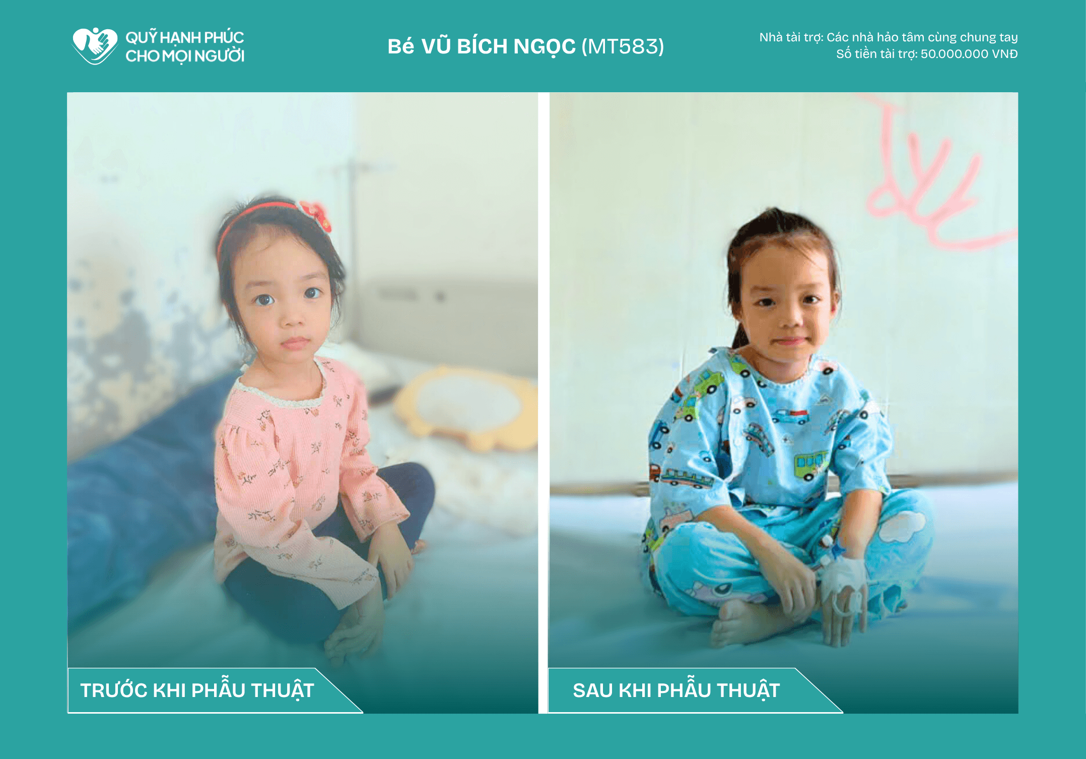 BÉ VŨ BÍCH NGỌC - MỘT TRÁI TIM NHỎ KHỎE MẠNH NHỜ TẤM LÒNG NHÂN ÁI