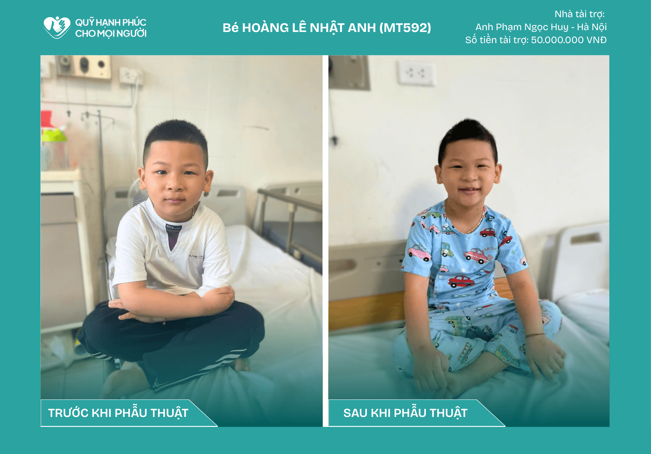 CHÚC MỪNG BÉ HOÀNG LÊ NHẬT ANH (MT592) ĐÃ ĐƯỢC RA VIỆN!