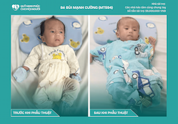 CHÚC MỪNG BÉ BÙI MẠNH CƯỜNG (MT594) ĐÃ ĐƯỢC RA VIỆN ❤️