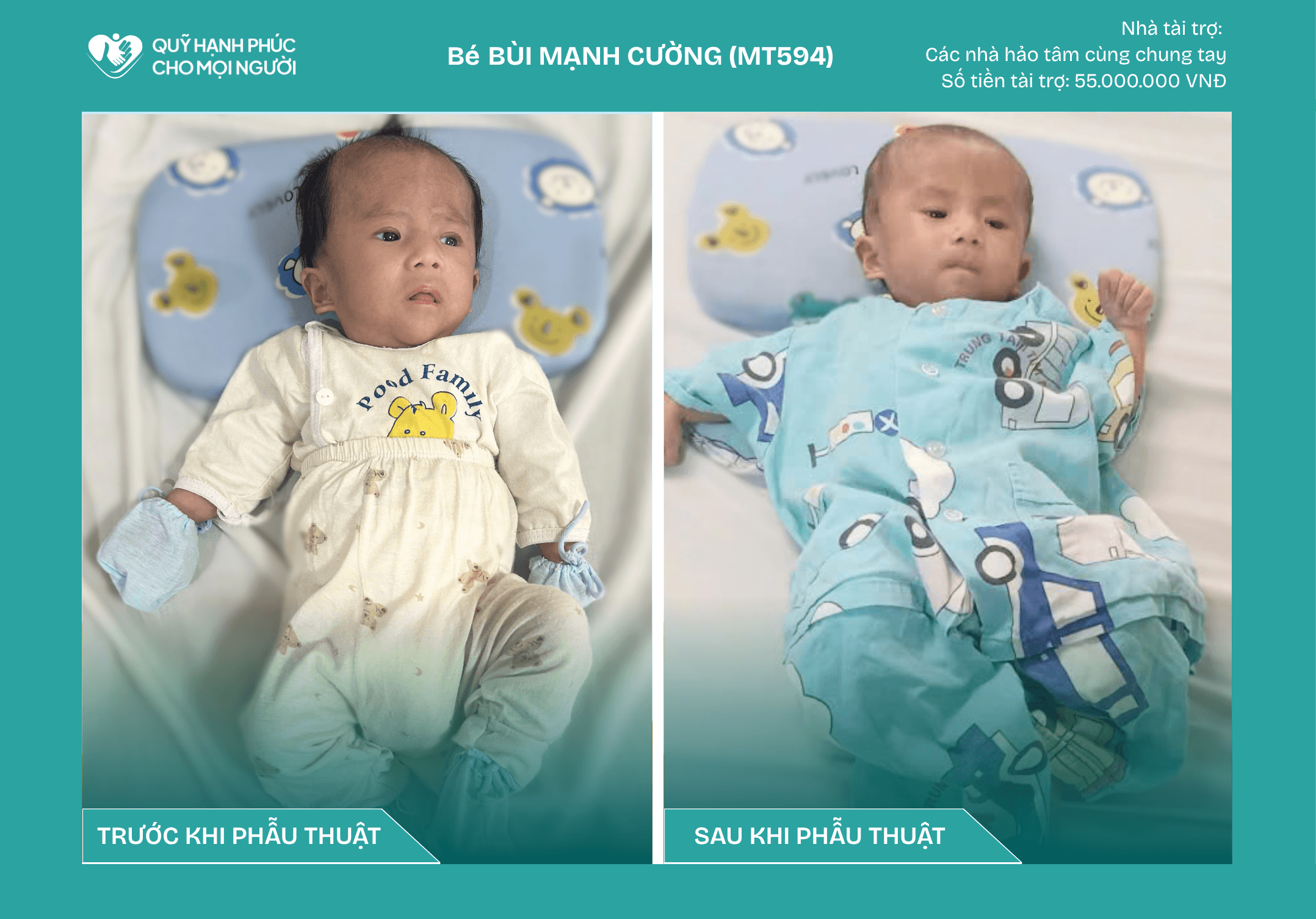 CHÚC MỪNG BÉ BÙI MẠNH CƯỜNG (MT594) ĐÃ ĐƯỢC RA VIỆN ❤️
