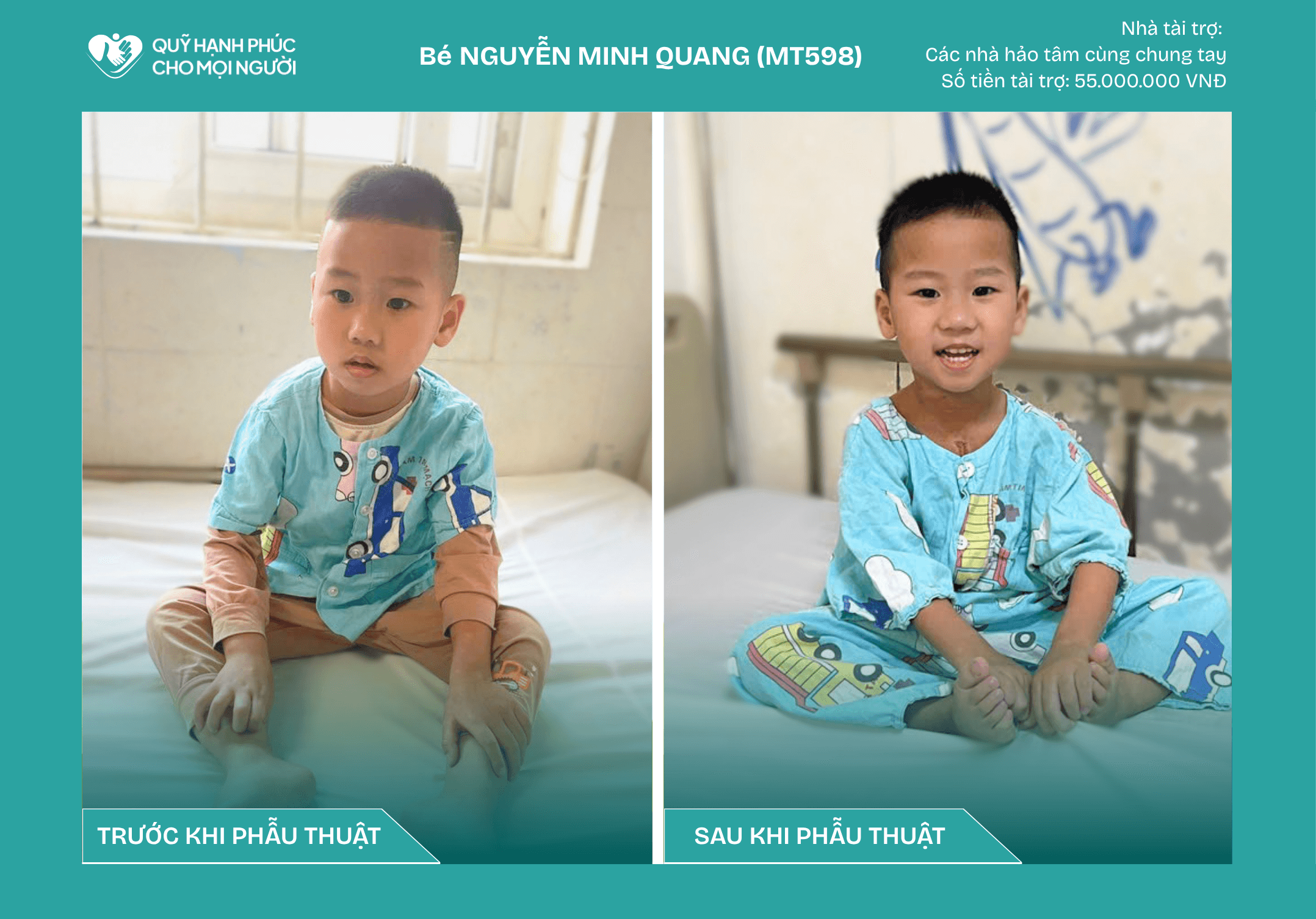 CHÚC MỪNG BÉ NGUYỄN MINH QUANG (MT598) ĐÃ ĐƯỢC RA VIỆN! ❤️