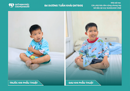 CHÚC MỪNG BÉ DƯƠNG TUẤN KHẢI (MT601) ĐÃ ĐƯỢC RA VIỆN! ❤️