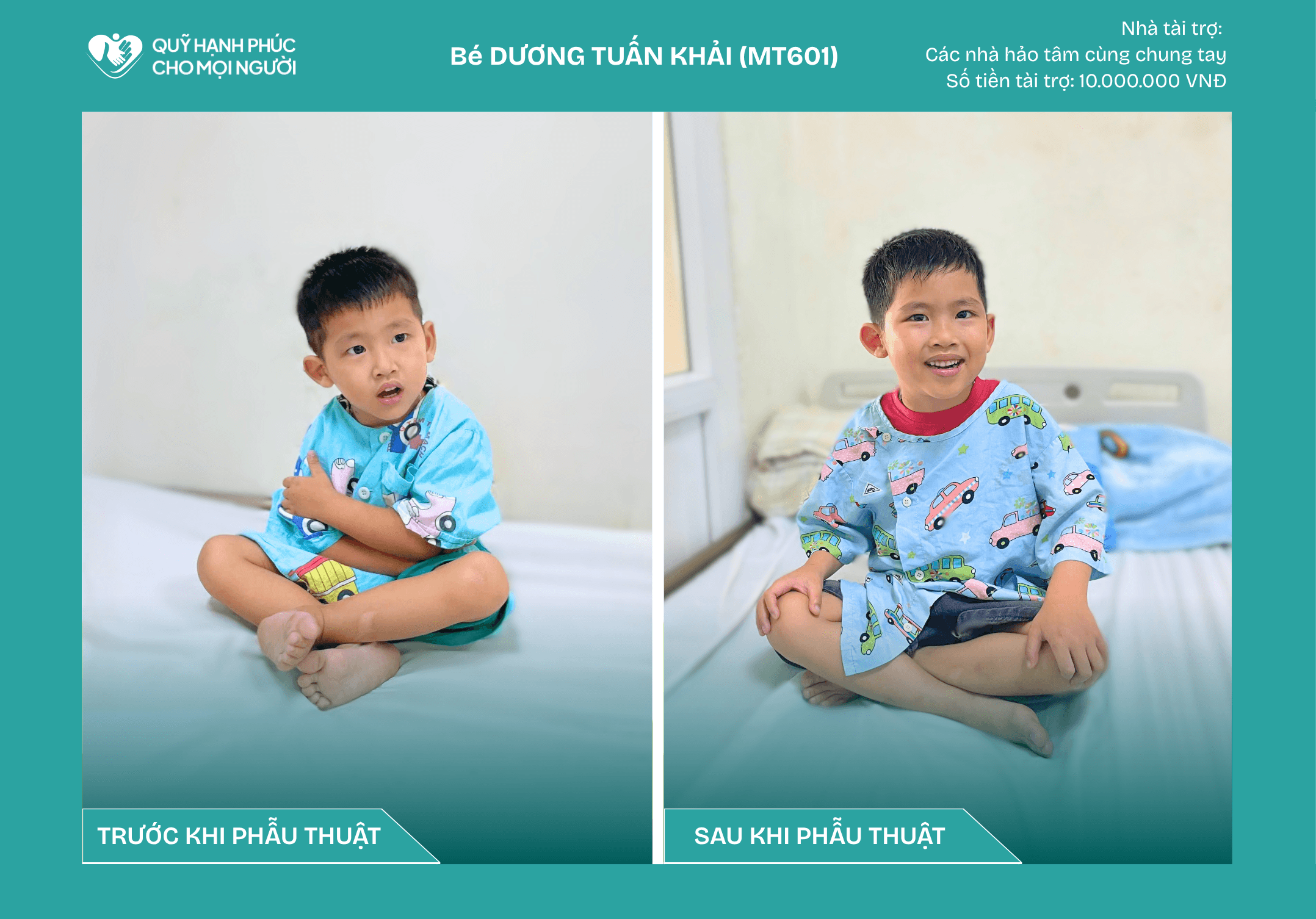 CHÚC MỪNG BÉ DƯƠNG TUẤN KHẢI (MT601) ĐÃ ĐƯỢC RA VIỆN! ❤️