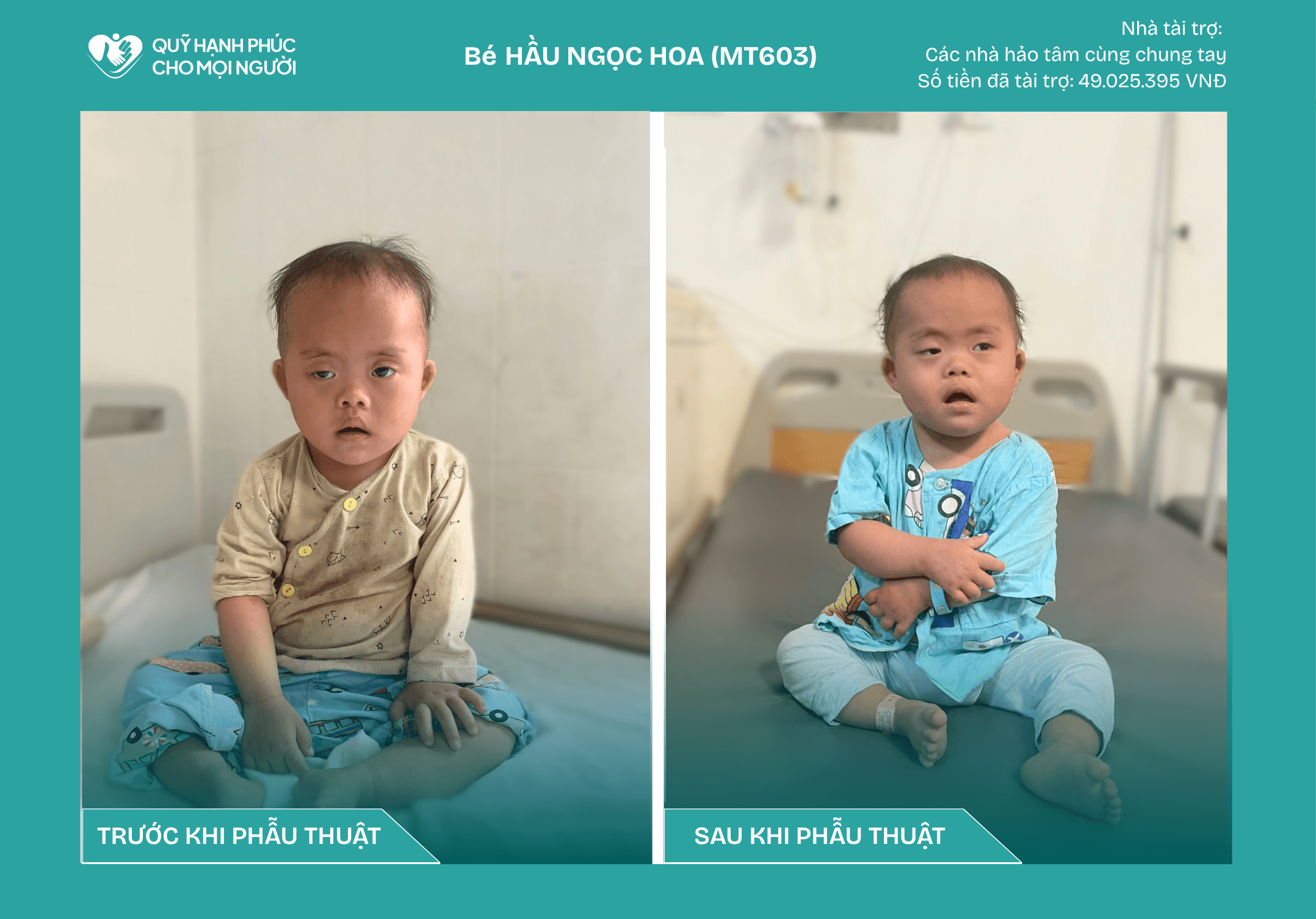 CHÚC MỪNG BÉ HẦU NGỌC HOA (CA SỐ 603) ĐÃ ĐƯỢC RA VIỆN!