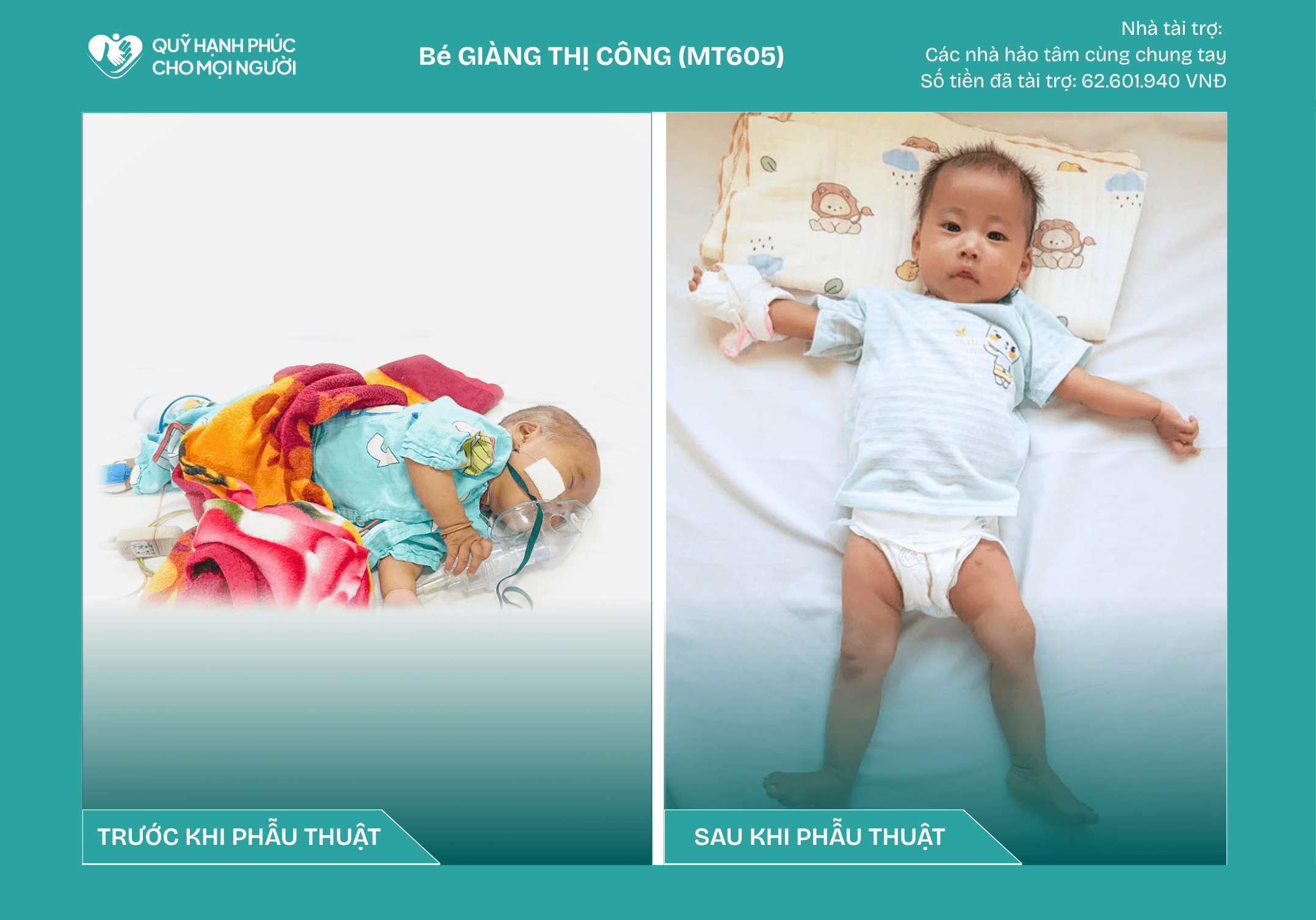 CHÚC MỪNG BÉ GIÀNG THỊ CÔNG (MT605) ĐÃ ĐƯỢC RA VIỆN ❤️