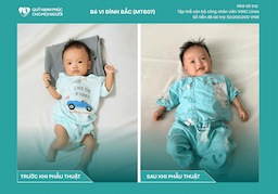 CHÚC MỪNG BÉ VI ĐÌNH BẮC (MT607) ĐÃ ĐƯỢC RA VIỆN ❤️