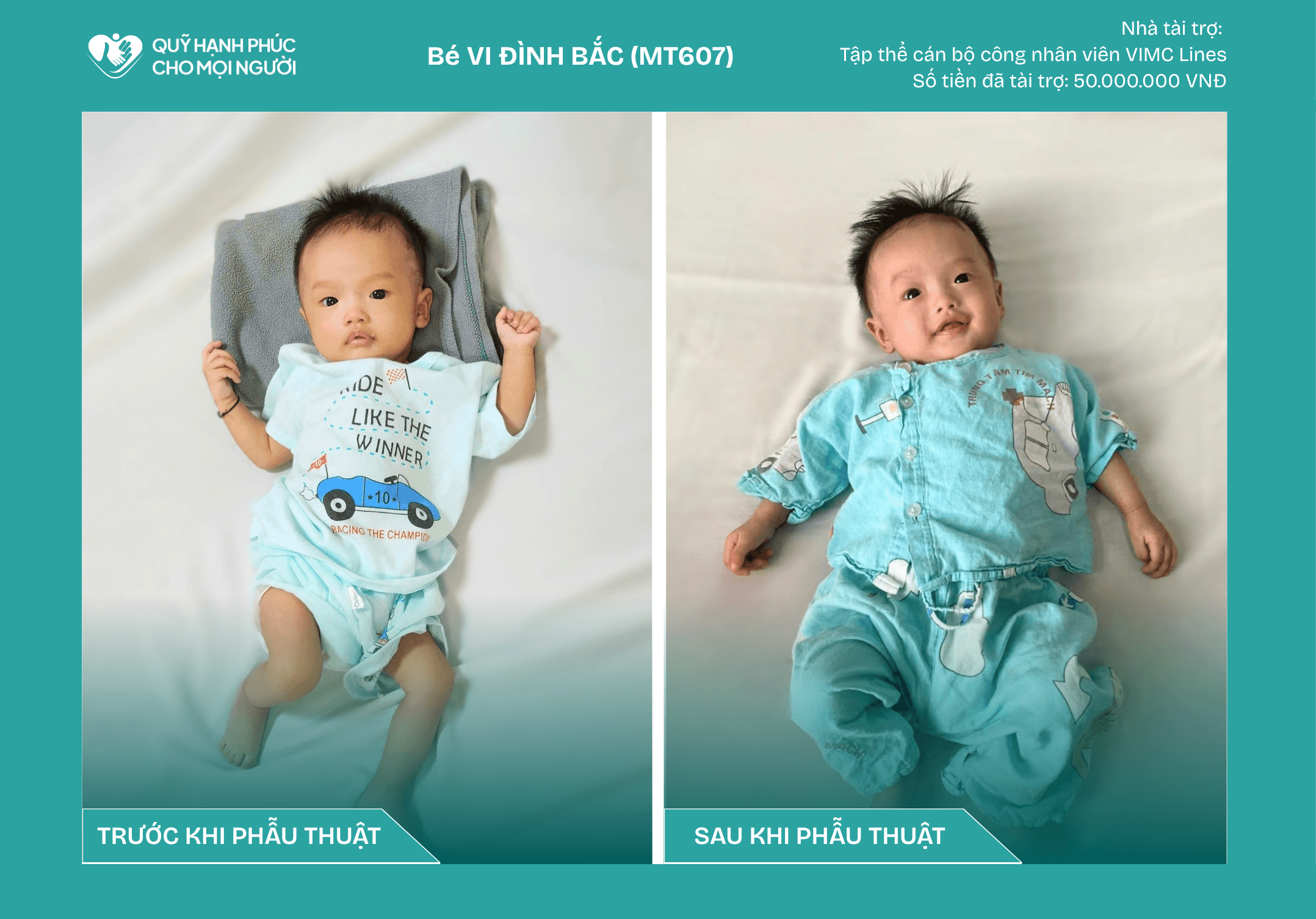 CHÚC MỪNG BÉ VI ĐÌNH BẮC (MT607) ĐÃ ĐƯỢC RA VIỆN ❤️