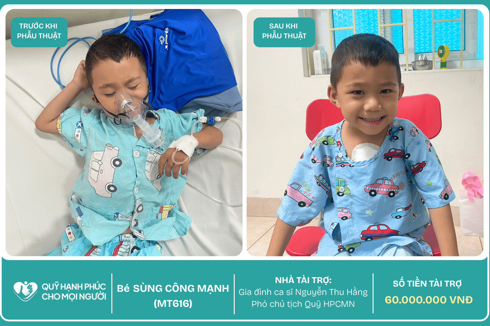 CHÚC MỪNG BÉ SÙNG CÔNG MẠNH (CA SỐ 616) ĐÃ ĐƯỢC RA VIỆN ❤️