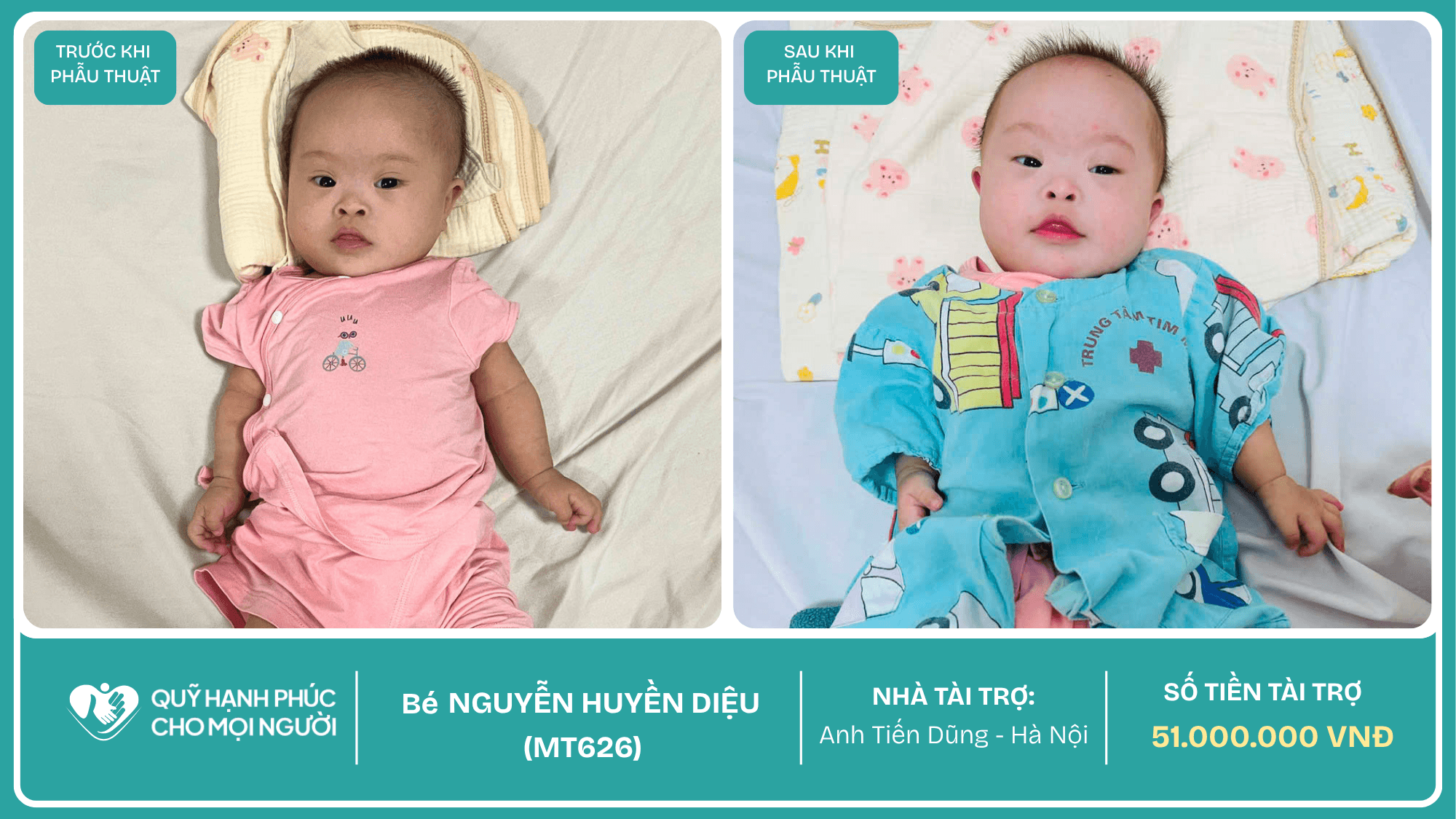 CHÚC MỪNG BÉ NGUYỄN HUYỀN DIỆU (CA SỐ 626) ĐÃ ĐƯỢC RA VIỆN ❤️